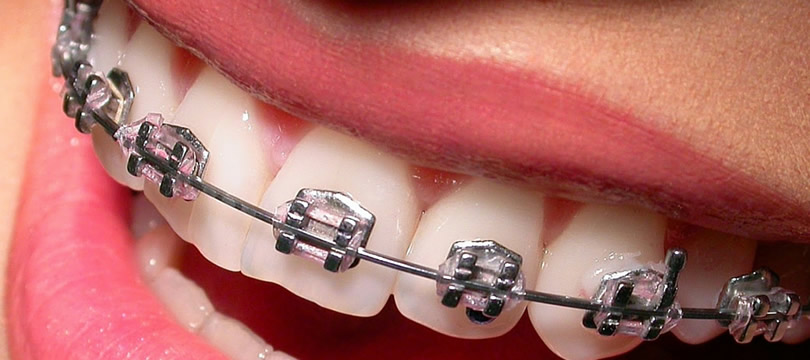 An application scenario or product detail of brackets metalicos - Image 7