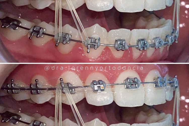 An application scenario or product detail of brackets metalicos - Image 10