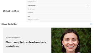 Clínica Dental Seis - Brackets Metálicos