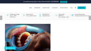 Clínica Dental Urbina - Brackets Metálicos y de Zafiro