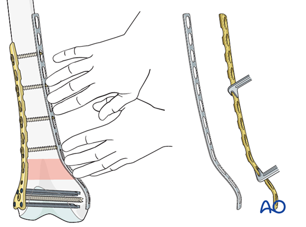 An application scenario or product detail of double plating - Image 8