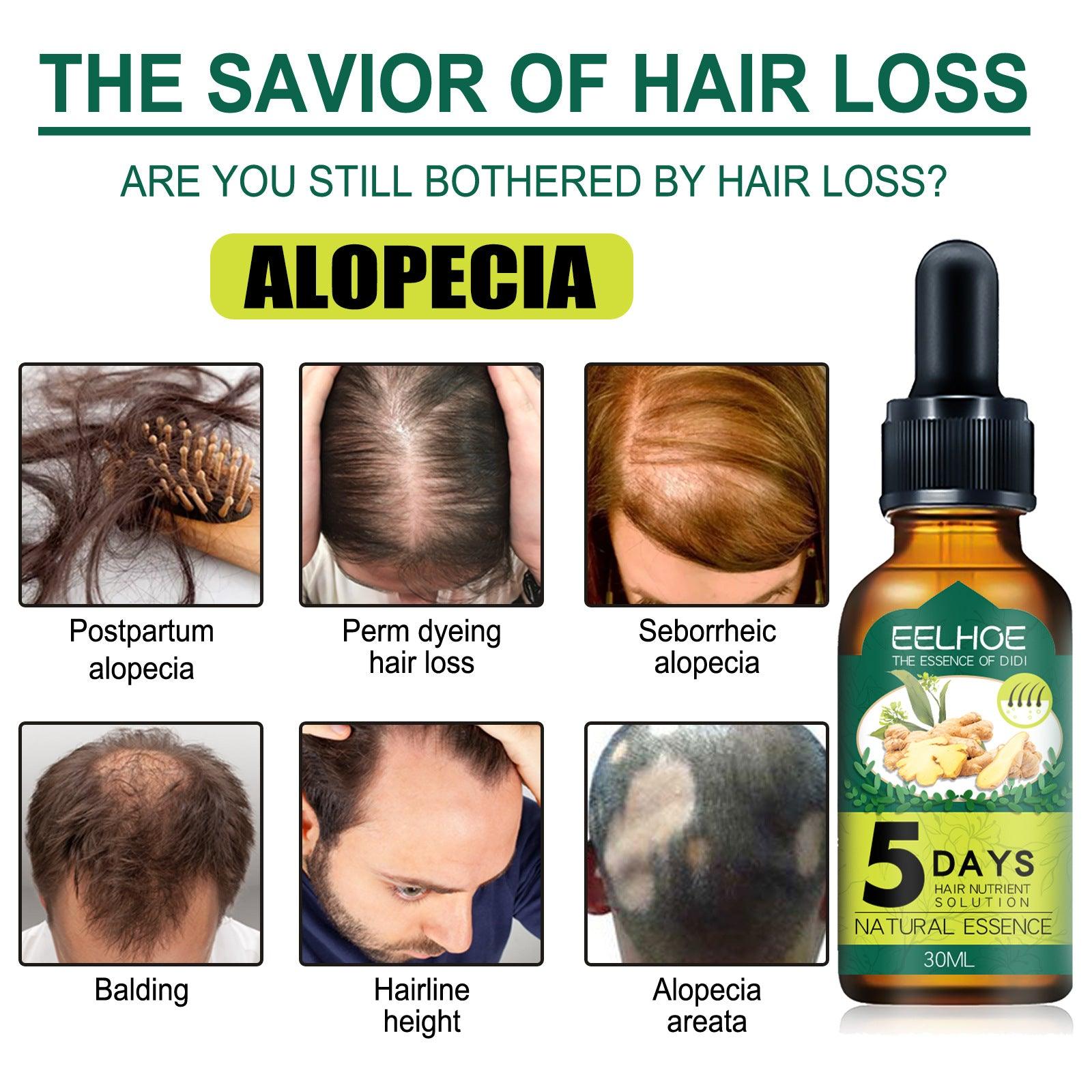 An application scenario or product detail of eelhoe hair growth oil - Image 5