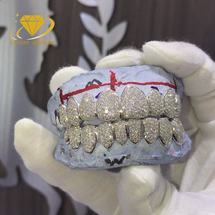 Featured image for the fake grillz guide