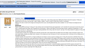 Hair Restoration Network - Dr. Ted Miln's 3500 Graft FUE