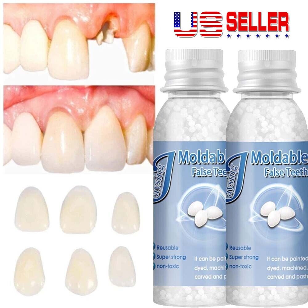 An application scenario or product detail of moldable false teeth - Image 3
