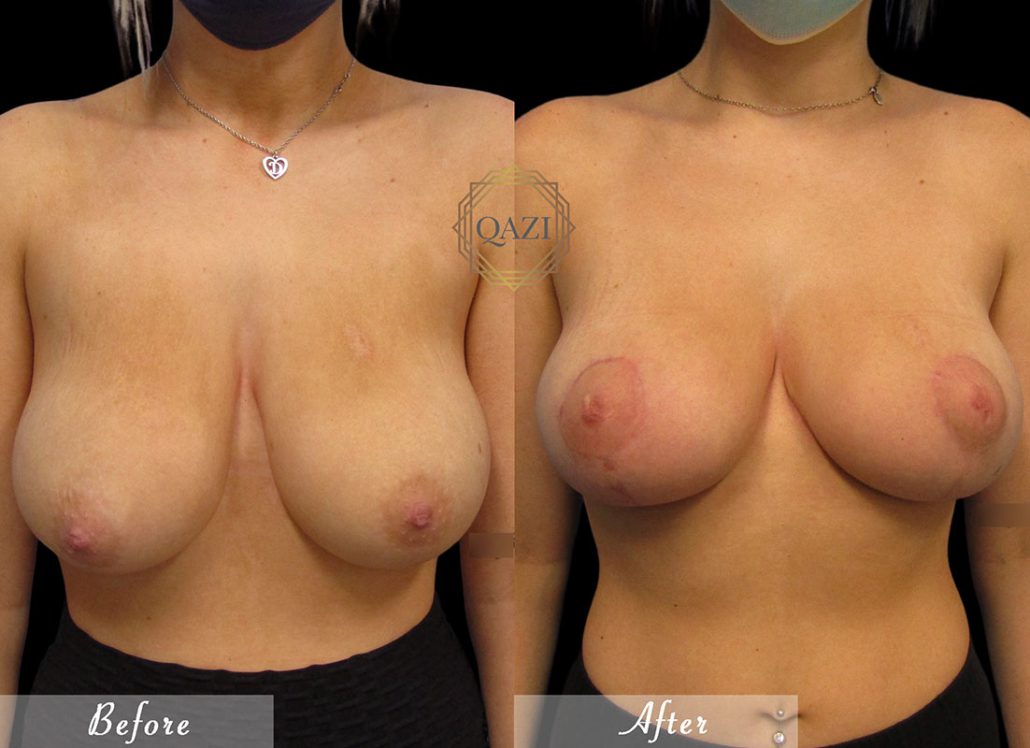 An application scenario or product detail of perfect fake boobs - Image 18