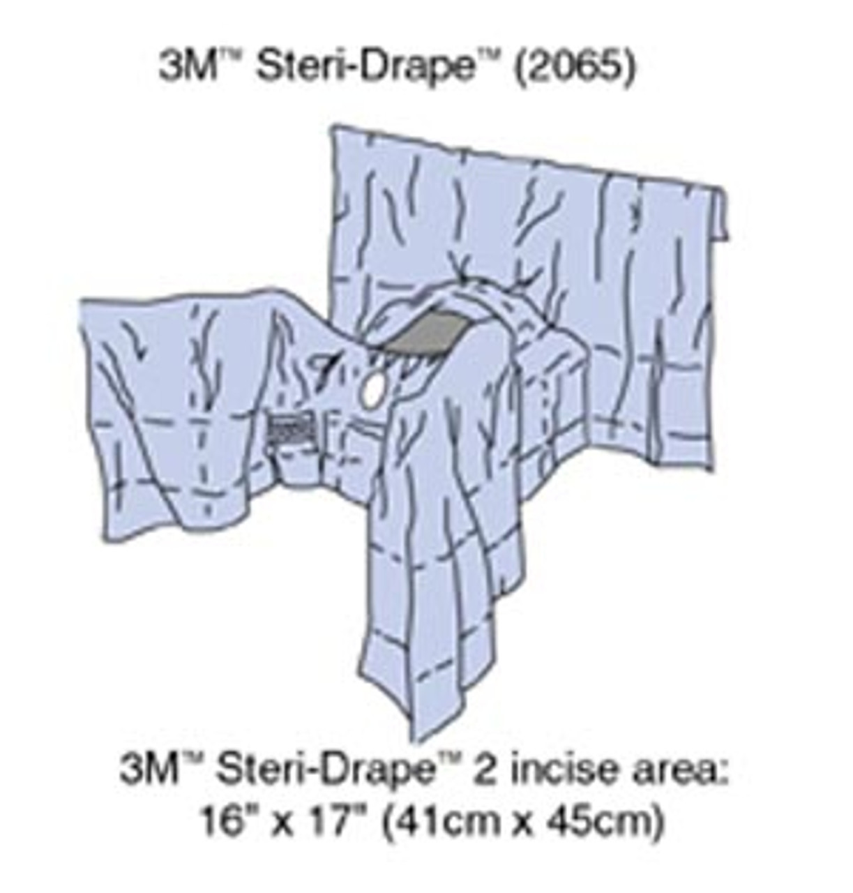 An application scenario or product detail of perineal fenestrated drape - Image 2