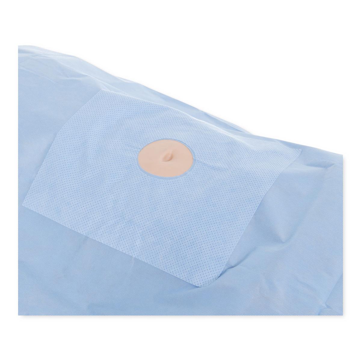An application scenario or product detail of perineal fenestrated drape - Image 22