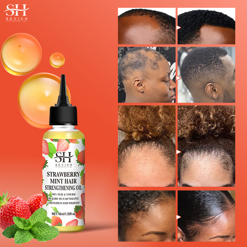 An application scenario or product detail of strawberry mint hair growth oil - Image 12