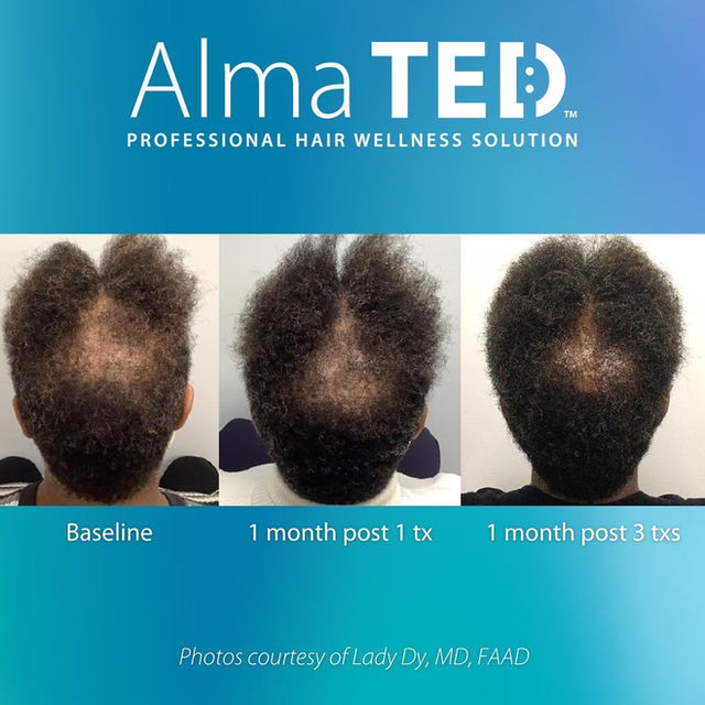 An application scenario or product detail of ted hair - Image 2