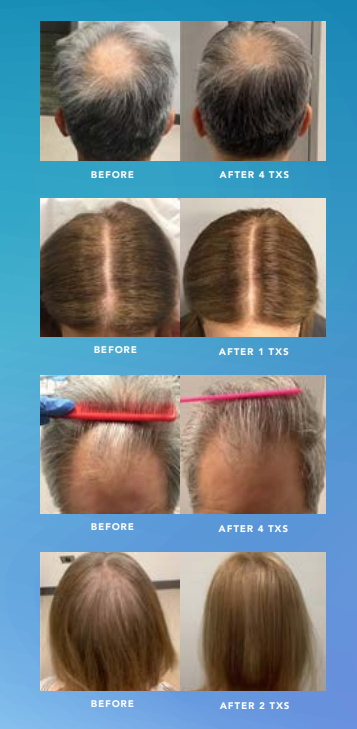 An application scenario or product detail of ted hair - Image 5