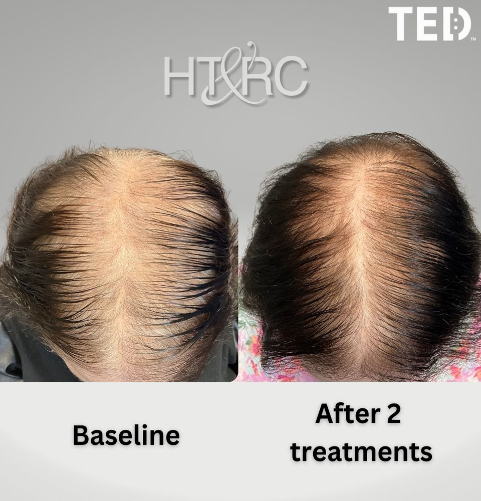 An application scenario or product detail of ted hair - Image 6