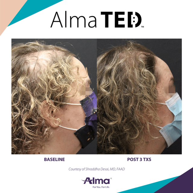 An application scenario or product detail of ted hair - Image 7