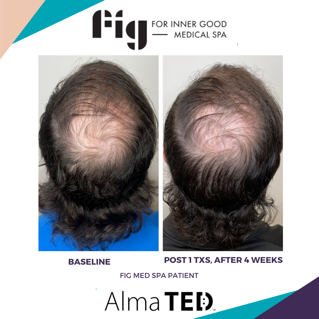 An application scenario or product detail of ted hair - Image 8