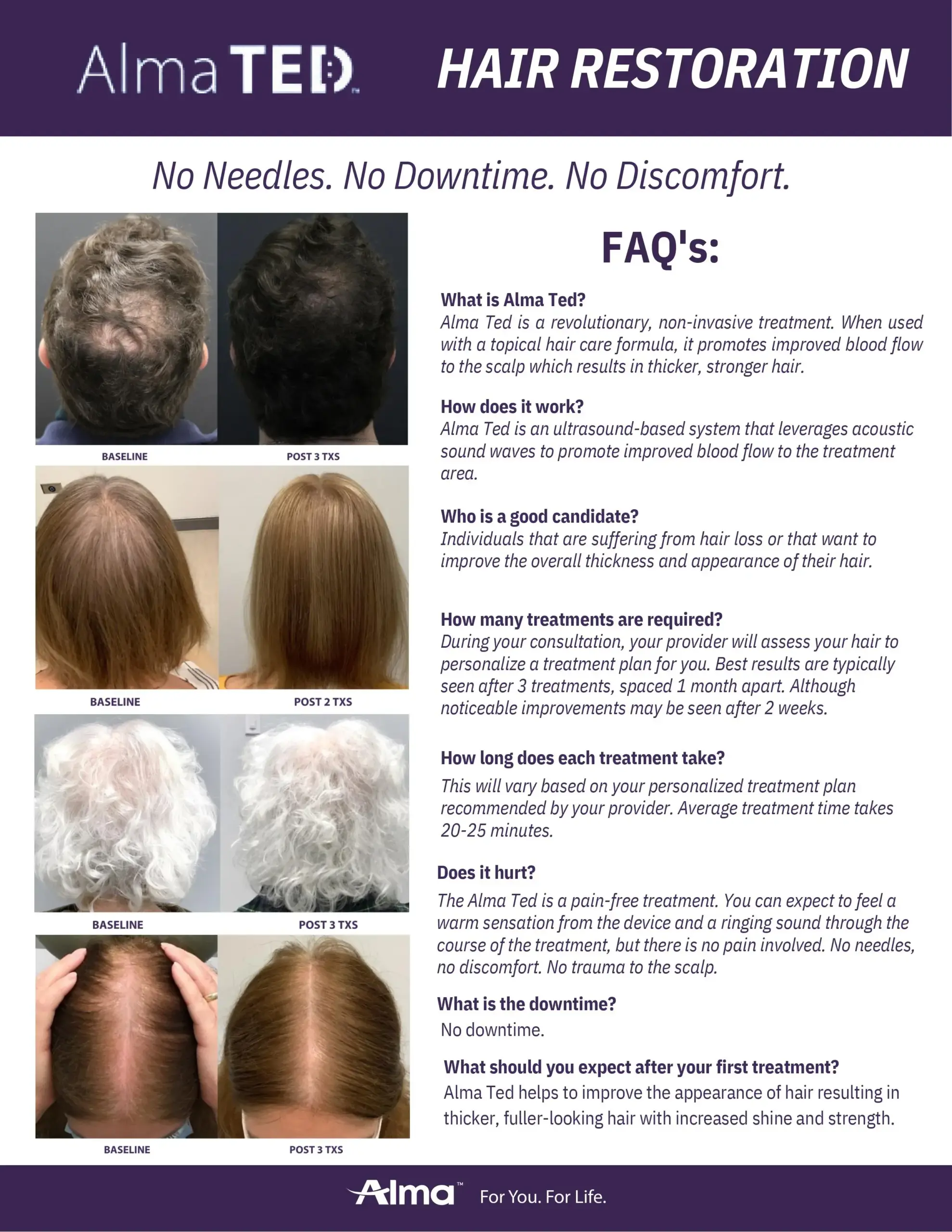 An application scenario or product detail of ted hair - Image 10