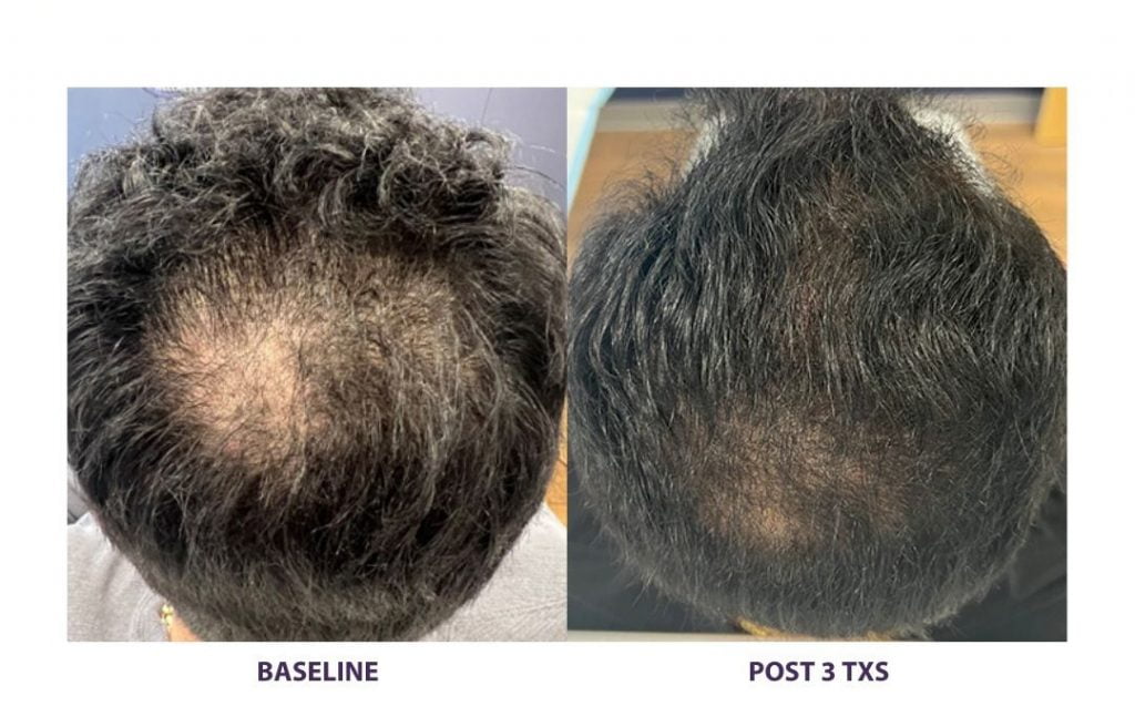 An application scenario or product detail of ted hair - Image 11