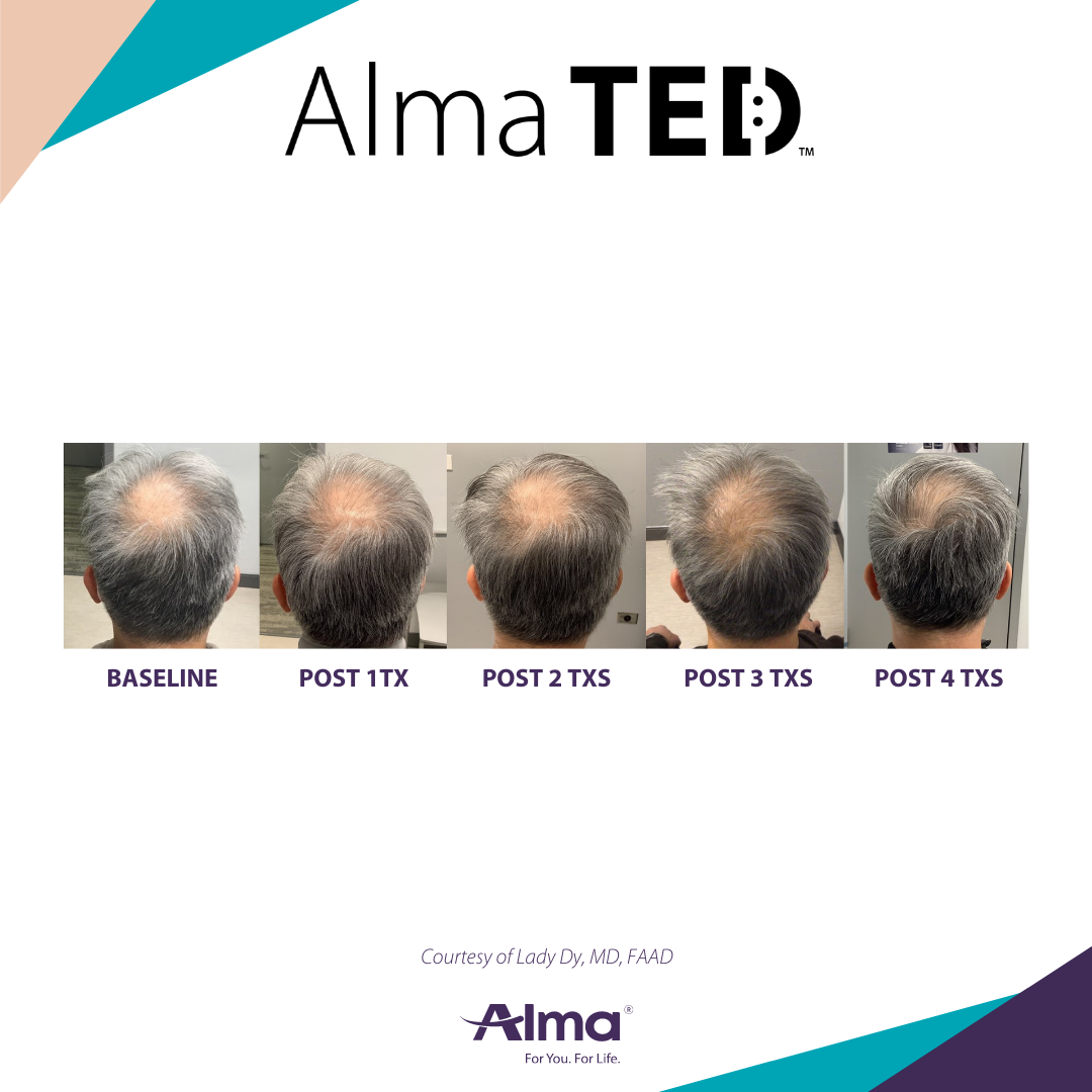 An application scenario or product detail of ted hair - Image 14