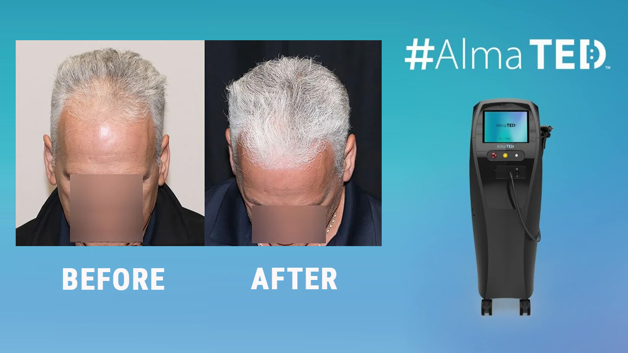 An application scenario or product detail of ted hair - Image 17