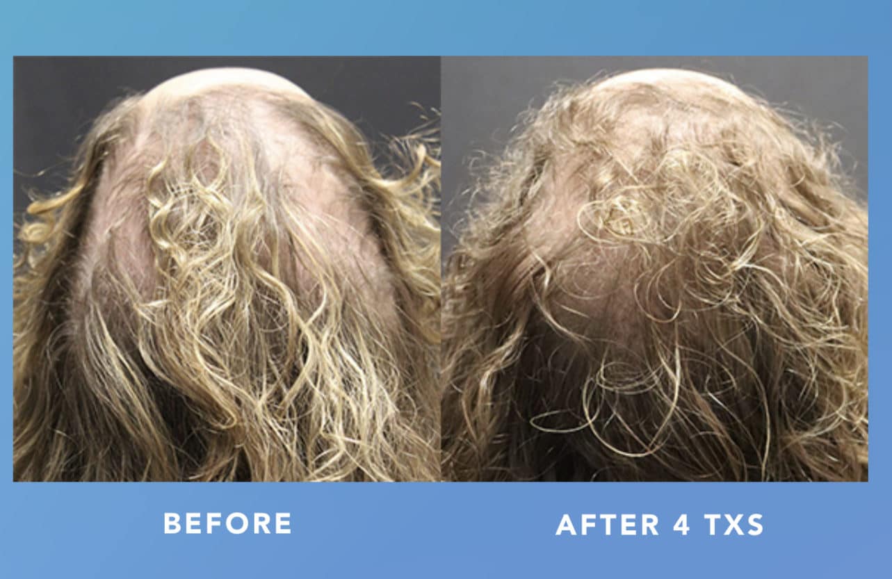 An application scenario or product detail of ted hair - Image 20