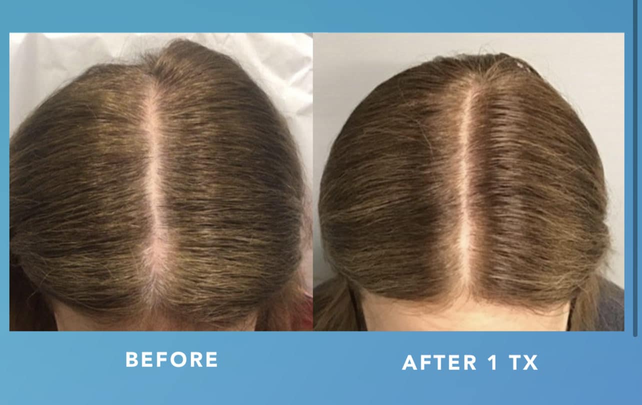 An application scenario or product detail of ted hair - Image 22