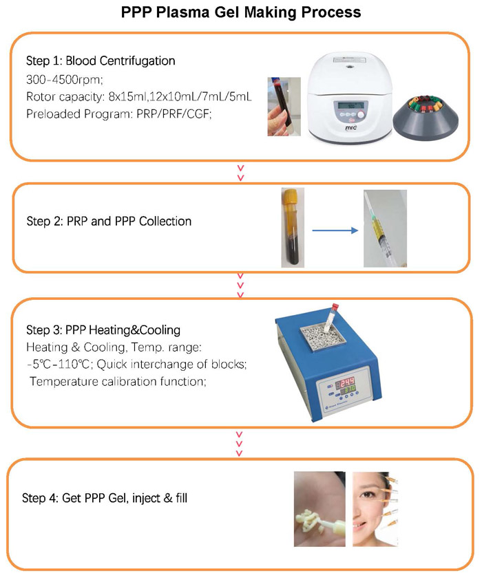 An application scenario or product detail of types of centrifuges - Image 14