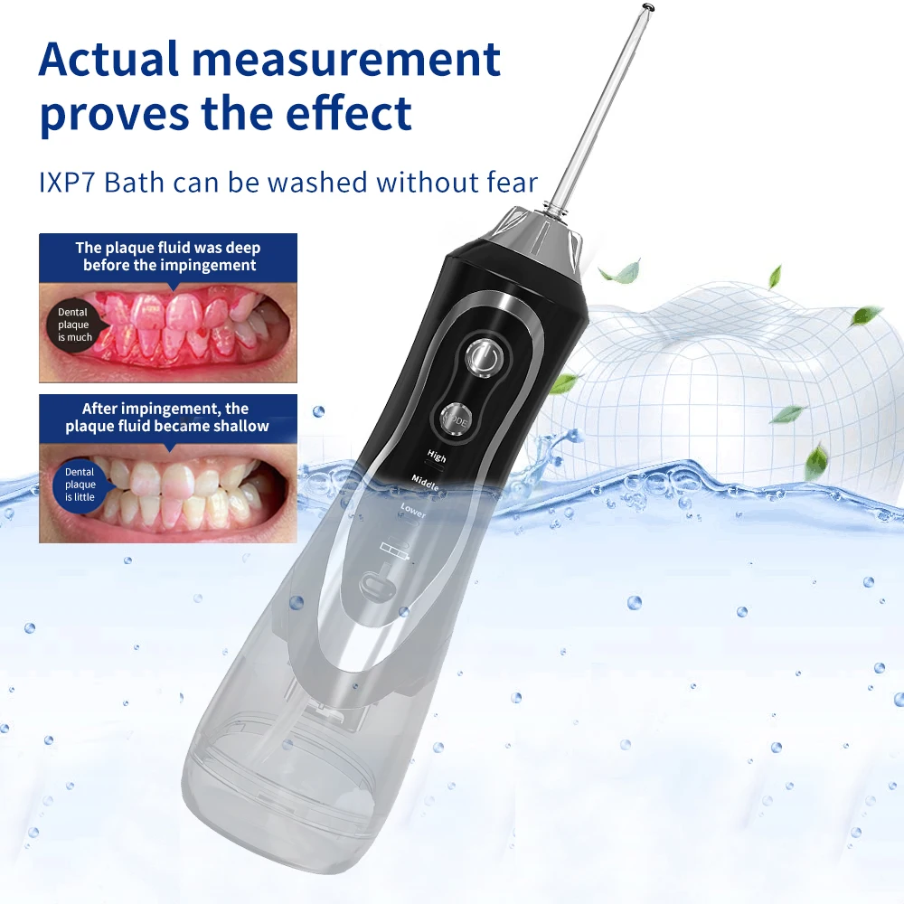 An application scenario or product detail of water flosser bpf-04-01 - Image 6