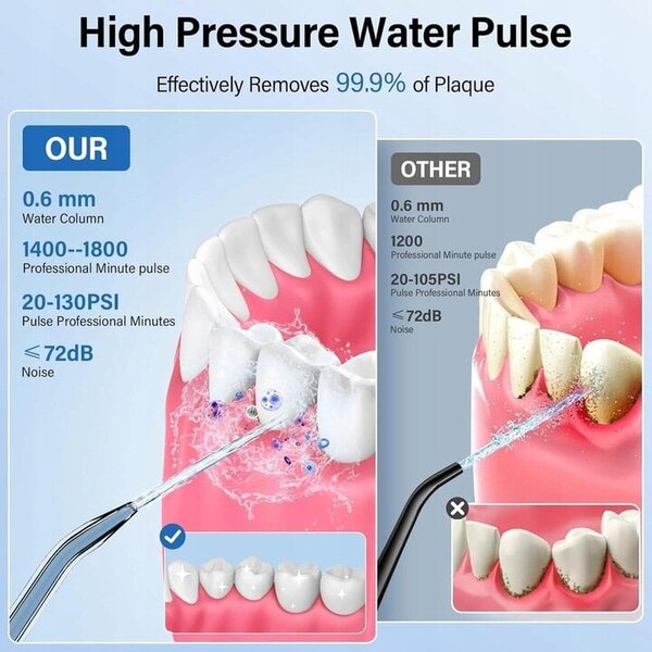 An application scenario or product detail of water flosser bpf-04-01 - Image 8